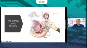 Ketahui, Transmisi Kanker Leher Rahim Melalui Dua Jalur