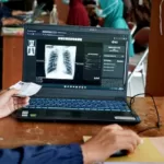 Tujuh Pendekatan Kemenkes Untuk Layanan Tuberkulosis