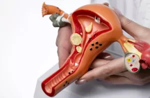 Skrining Sedini Mungkin Langkah Awal Deteksi Kanker Serviks