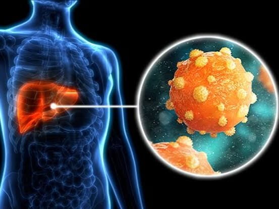 Ancaman Serius Hepatitis Bagi Kesehatan Hati dan Tubuh