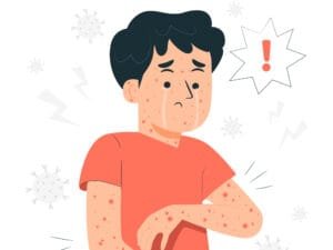 Di Targetkan Bebas NTDs pada 2030, Indonesia Percepat Eliminasi Kusta dan Filariasis